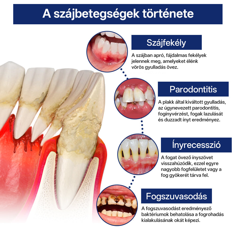 Rolimey® BeeTakt Méhméreg Fogápoló Cseppek Szájvíz✅