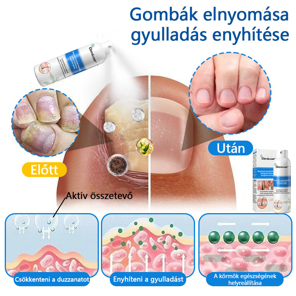 CleraLuxe® Magnézium Gyógynövényes Pszoriázis Spray✅
