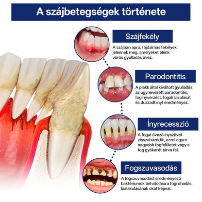 Rolimey® BeeTakt Méhméreg Fogápoló Cseppek Szájvíz✅