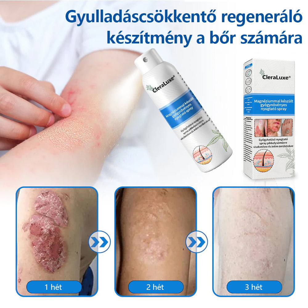 CleraLuxe®  Magnézium Gyógynövényes Pszoriázis Spray💦