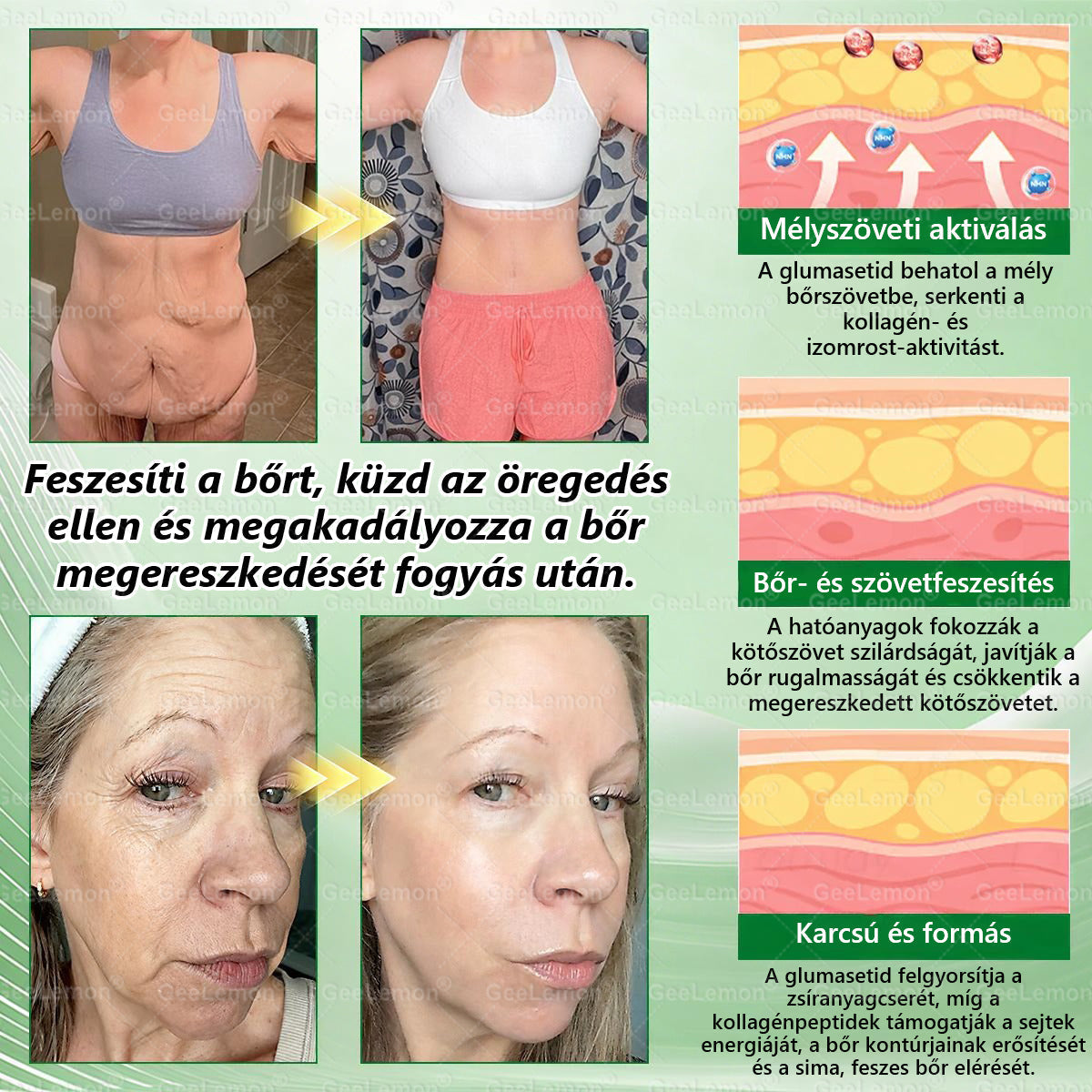 💎𝐆𝐞𝑒𝐿𝑒𝐦𝐨𝐧® Glumasetide 8 az 1-ben Karcsú és Egészséges Nano Mikrotűs Tapasz🩹