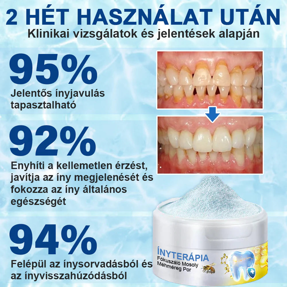Furzero® 𝑭𝒐𝒄𝒖𝒔𝒔𝒎𝒊𝒍𝒆 – Méhméreges szájápoló por✅️