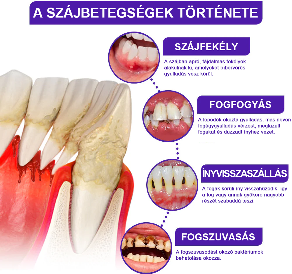 🌟Rolimey® VioCore Méhméreg Fogkezelő Fogkrém📢