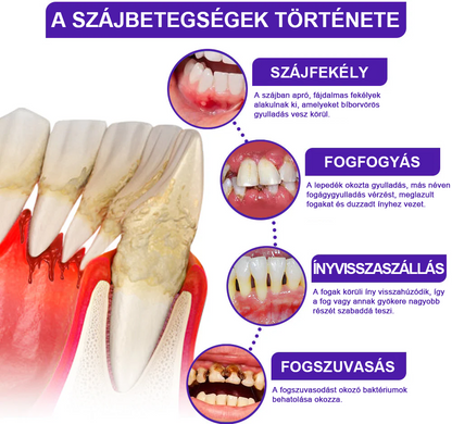 🌟Rolimey® VioCore Méhméreg Fogkezelő Fogkrém📢