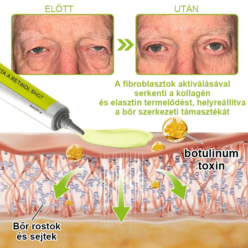 ✨ Vosxu™ Botox & Vita-A Retinol Shot ráncfelvarró szérum ✨ – 💉 Mikro-tűk | 💪 Botox-szerű peptidek | 🌿 Retinol | ⚡ Látható eredmények már 3 nap alatt🎁