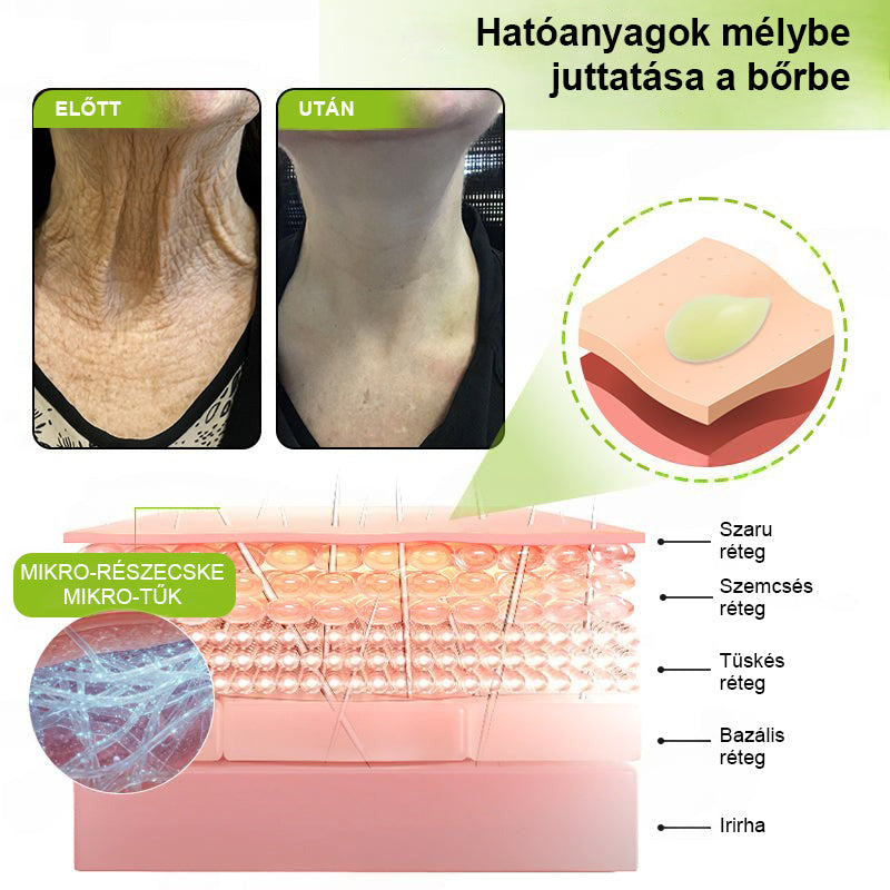 ✨ Vosxu™ Botox & Vita-A Retinol Shot ráncfelvarró szérum ✨ – 💉 Mikro-tűk | 💪 Botox-szerű peptidek | 🌿 Retinol | ⚡ Látható eredmények már 3 nap alatt🎁