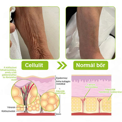 ✨ Vosxu™ Botox & Vita-A Retinol Shot ráncfelvarró szérum ✨ – 💉 Mikro-tűk | 💪 Botox-szerű peptidek | 🌿 Retinol | ⚡ Látható eredmények már 3 nap alatt🎁