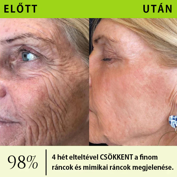 ✨ Vosxu™ Botox & Vita-A Retinol Shot ráncfelvarró szérum ✨ – 💉 Mikro-tűk | 💪 Botox-szerű peptidek | 🌿 Retinol | ⚡ Látható eredmények már 3 nap alatt🎁
