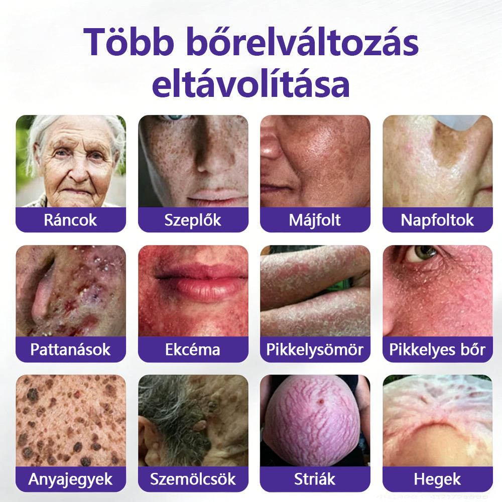👩🏻‍⚕️COLTURE® szemölcs- és anyajegytávolító mikrotűs tapasz🎁