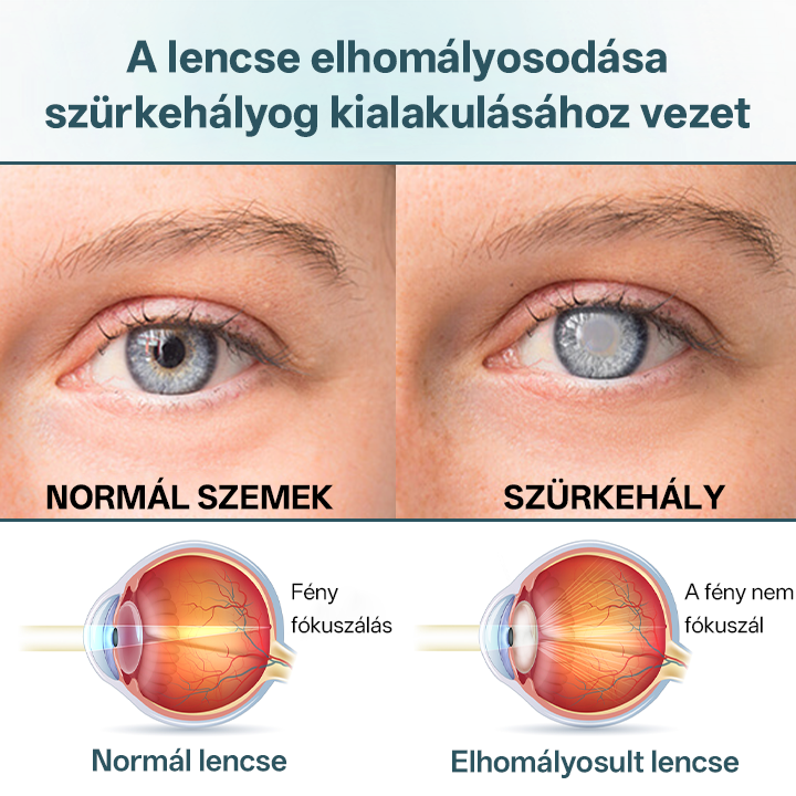 Timilk® OptiFusion Nano szemcsepp szérum🔥