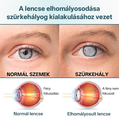 Timilk® OptiFusion Nano szemcsepp szérum🔥