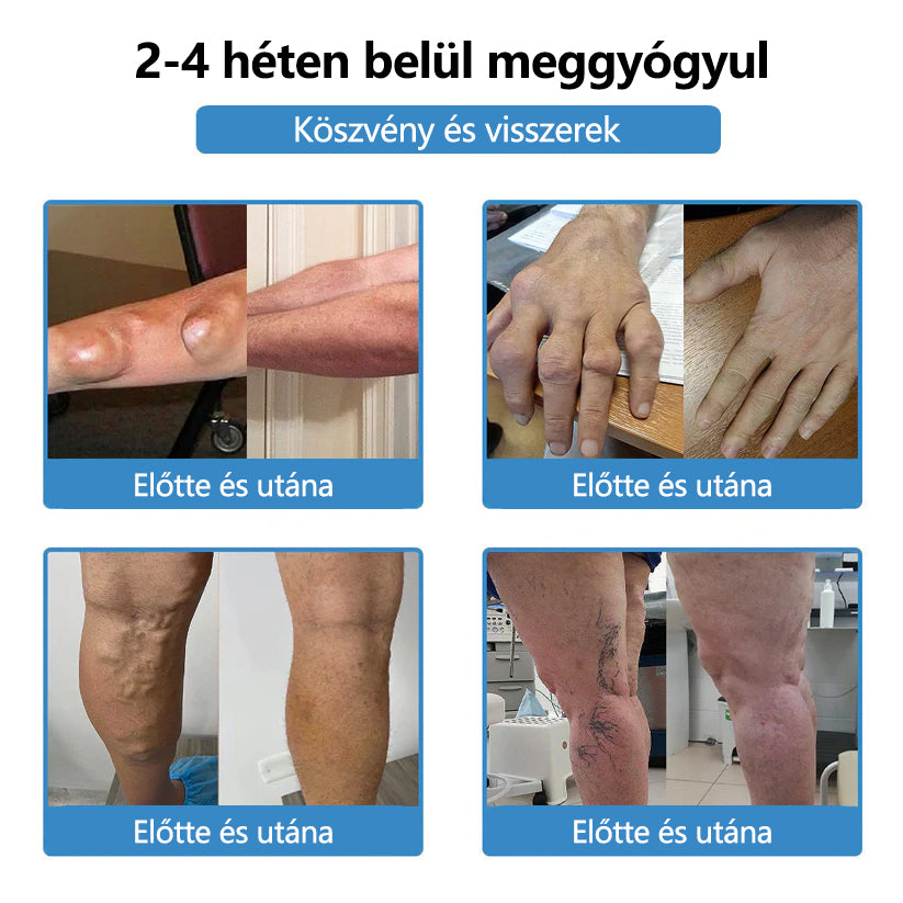 ClearaNature® Nano-tűs közös tapasz🔥