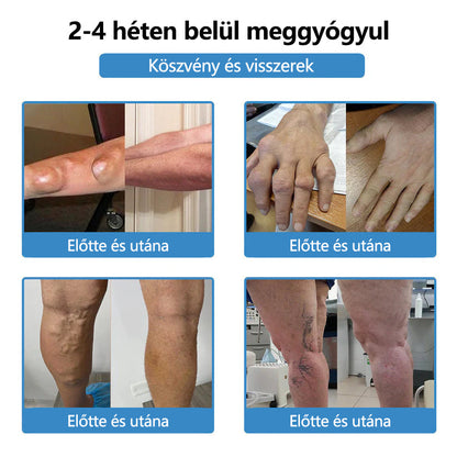 ClearaNature® Nano-tűs közös tapasz🔥