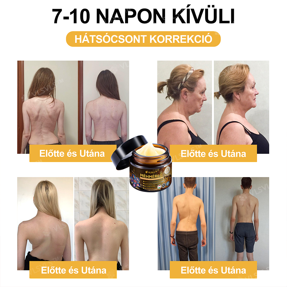✨VLSVLS™ Méhméreg Azonnali Ultra Erős Fájdalomcsillapító Krém👍 - (Enyhíti a fájdalmat ízületi gyulladás, izomfájdalom, hátfájás, térdek, hát, vállak, csípők, csuklók, kezek esetén)