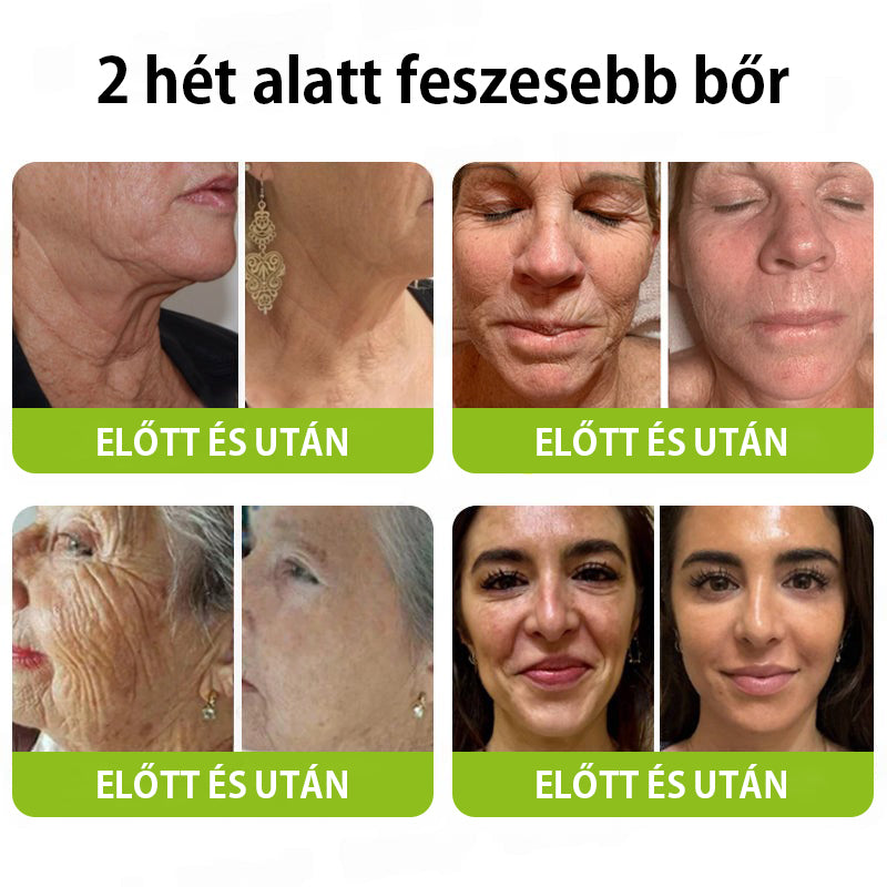 ✨ Vosxu™ Botox & Vita-A Retinol Shot ráncfelvarró szérum ✨ – 💉 Mikro-tűk | 💪 Botox-szerű peptidek | 🌿 Retinol | ⚡ Látható eredmények már 3 nap alatt🎁