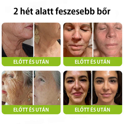 ✨ Vosxu™ Botox & Vita-A Retinol Shot ráncfelvarró szérum ✨ – 💉 Mikro-tűk | 💪 Botox-szerű peptidek | 🌿 Retinol | ⚡ Látható eredmények már 3 nap alatt🎁