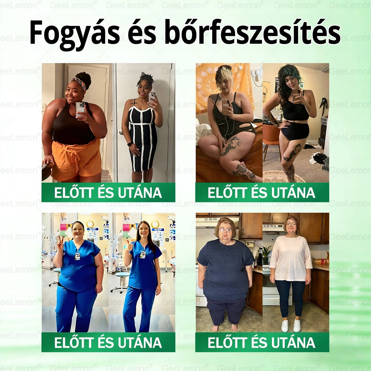 💎𝐆𝐞𝑒𝐿𝑒𝐦𝐨𝐧® Glumasetide 8 az 1-ben Karcsú és Egészséges Nano Mikrotűs Tapasz🩹