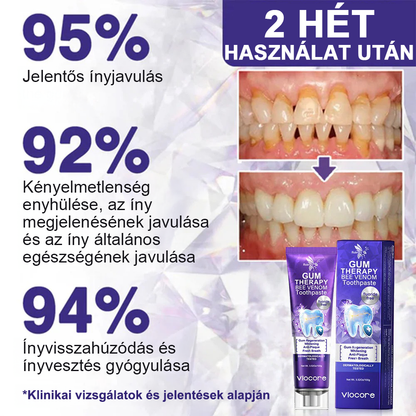 🌟Rolimey® VioCore Méhméreg Fogkezelő Fogkrém📢