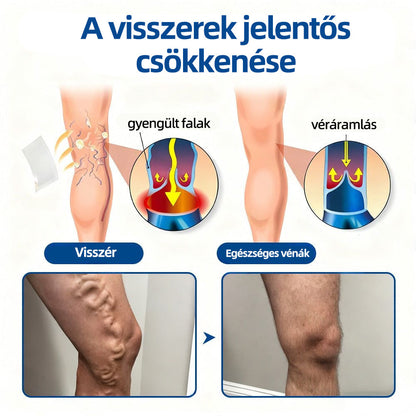 🇭🇺Yutuof® 👩‍⚕️VeinTarget mikrotűs tapasz⚡☑️Azonnali enyhülés hosszú távú eredmények⭐️