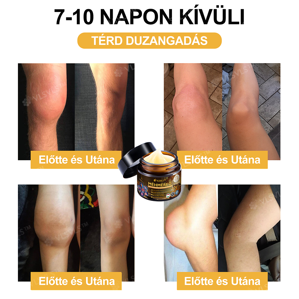 ✨VLSVLS™ Méhméreg Azonnali Ultra Erős Fájdalomcsillapító Krém👍 - (Enyhíti a fájdalmat ízületi gyulladás, izomfájdalom, hátfájás, térdek, hát, vállak, csípők, csuklók, kezek esetén)