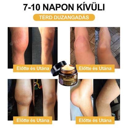 ✨VLSVLS™ Méhméreg Azonnali Ultra Erős Fájdalomcsillapító Krém👍 - (Enyhíti a fájdalmat ízületi gyulladás, izomfájdalom, hátfájás, térdek, hát, vállak, csípők, csuklók, kezek esetén)