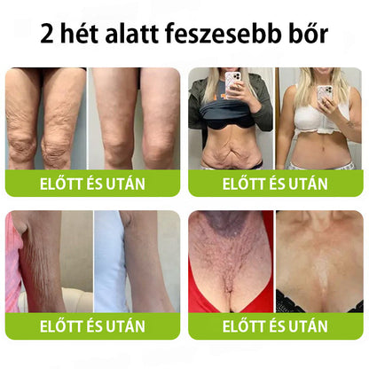 ✨ Vosxu™ Botox & Vita-A Retinol Shot ráncfelvarró szérum ✨ – 💉 Mikro-tűk | 💪 Botox-szerű peptidek | 🌿 Retinol | ⚡ Látható eredmények már 3 nap alatt🎁