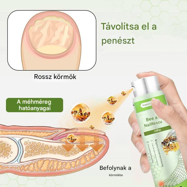 Korlátozott ideig 50%-os kedvezmény | Foulme® NailRescue Méhméreg Spray🎁