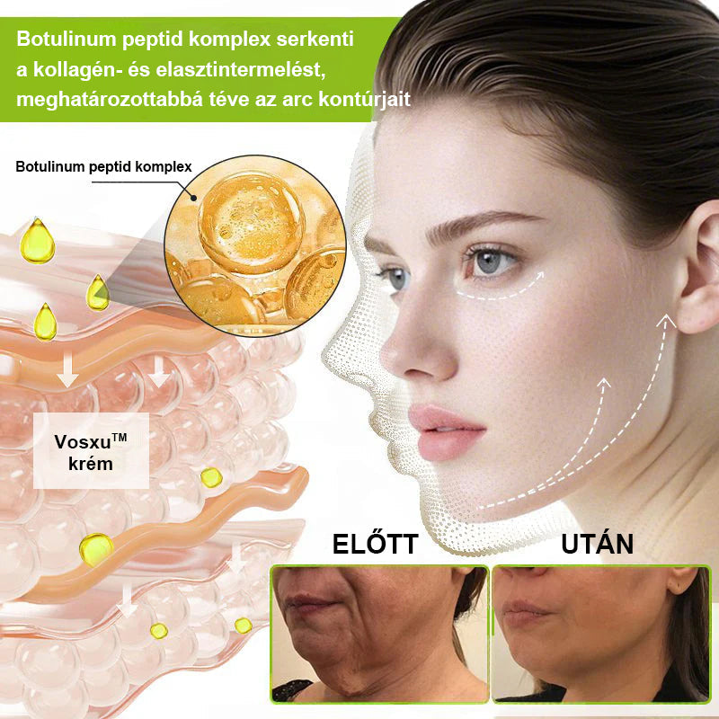 ✨ Vosxu™ Botox & Vita-A Retinol Shot ráncfelvarró szérum ✨ – 💉 Mikro-tűk | 💪 Botox-szerű peptidek | 🌿 Retinol | ⚡ Látható eredmények már 3 nap alatt🎁
