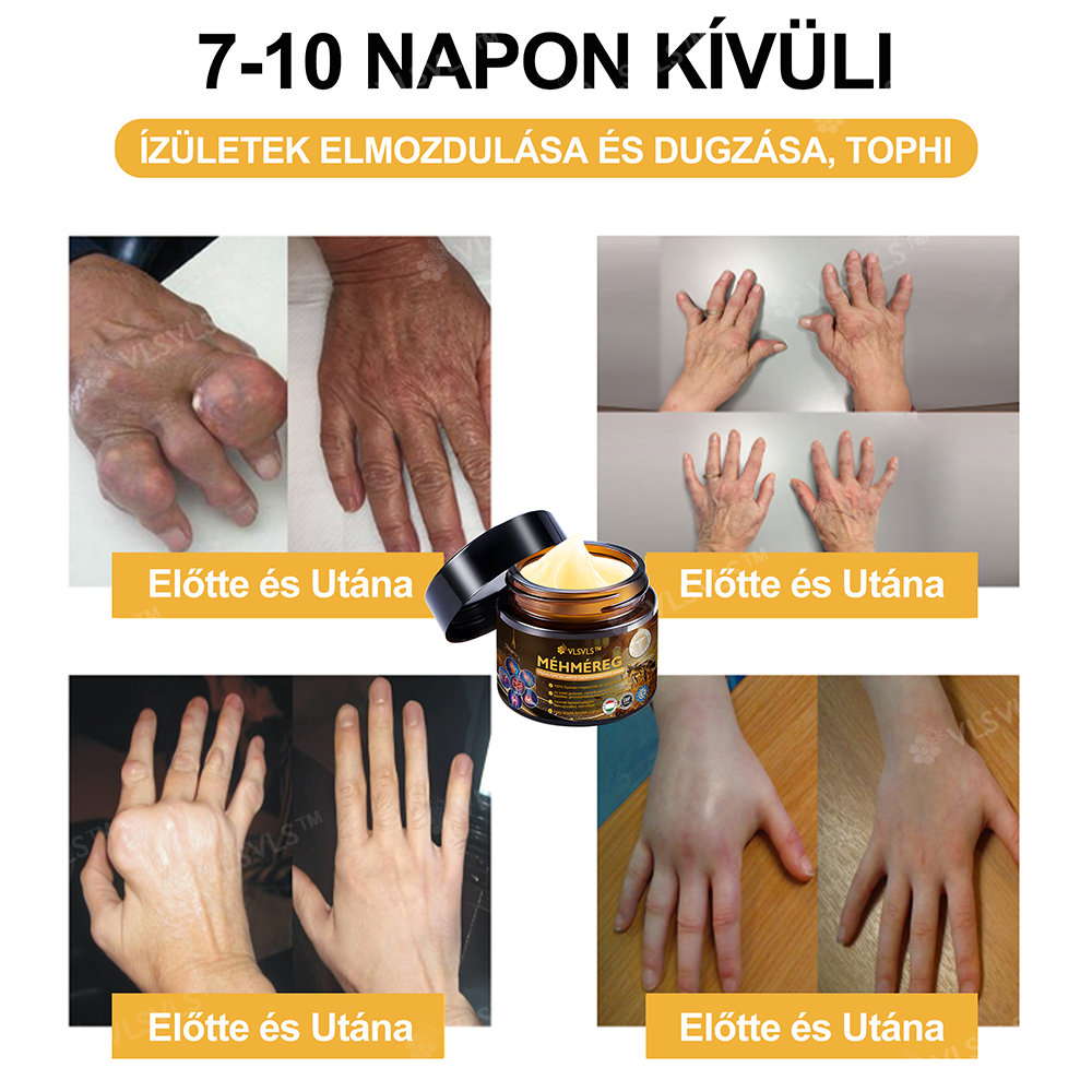 ✨VLSVLS™ Méhméreg Azonnali Ultra Erős Fájdalomcsillapító Krém👍 - (Enyhíti a fájdalmat ízületi gyulladás, izomfájdalom, hátfájás, térdek, hát, vállak, csípők, csuklók, kezek esetén)