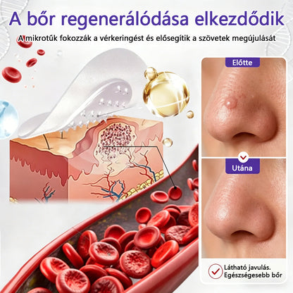 👩🏻‍⚕️COLTURE® szemölcs- és anyajegytávolító mikrotűs tapasz🎁