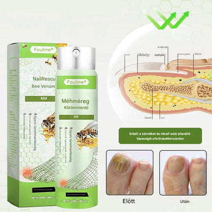 Korlátozott ideig 50%-os kedvezmény | Foulme® NailRescue Méhméreg Spray🎁