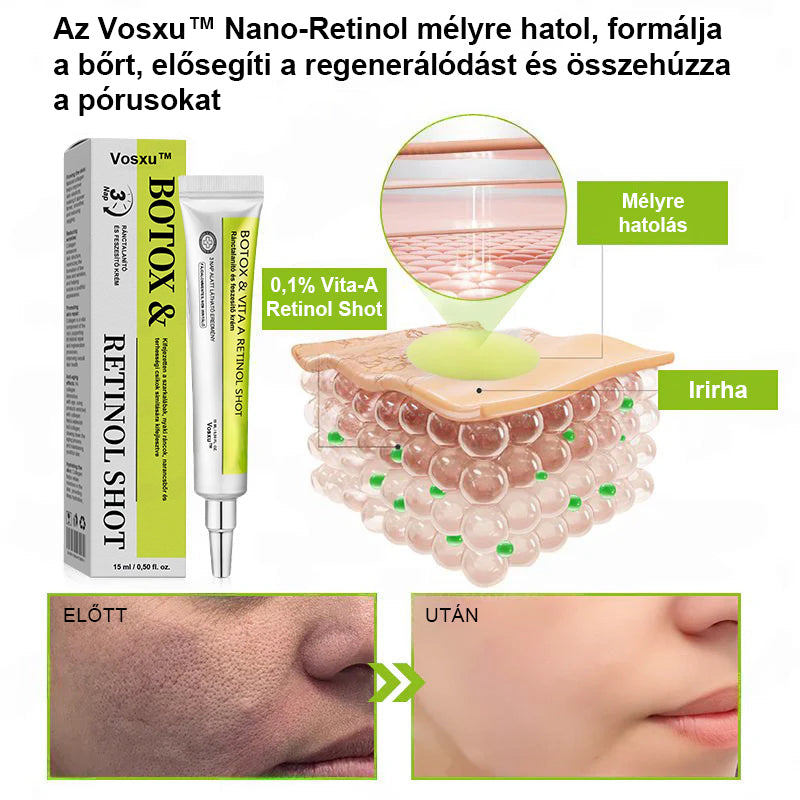 ✨ Vosxu™ Botox & Vita-A Retinol Shot ráncfelvarró szérum ✨ – 💉 Mikro-tűk | 💪 Botox-szerű peptidek | 🌿 Retinol | ⚡ Látható eredmények már 3 nap alatt🎁