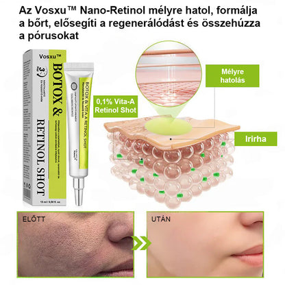 ✨ Vosxu™ Botox & Vita-A Retinol Shot ráncfelvarró szérum ✨ – 💉 Mikro-tűk | 💪 Botox-szerű peptidek | 🌿 Retinol | ⚡ Látható eredmények már 3 nap alatt🎁