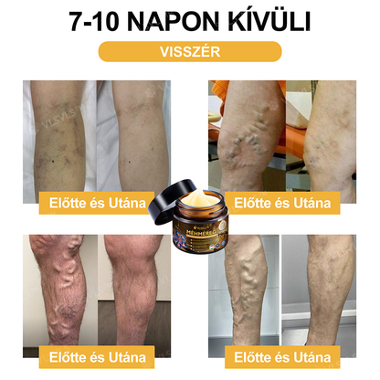 ✨VLSVLS™ Méhméreg Azonnali Ultra Erős Fájdalomcsillapító Krém👍 - (Enyhíti a fájdalmat ízületi gyulladás, izomfájdalom, hátfájás, térdek, hát, vállak, csípők, csuklók, kezek esetén)