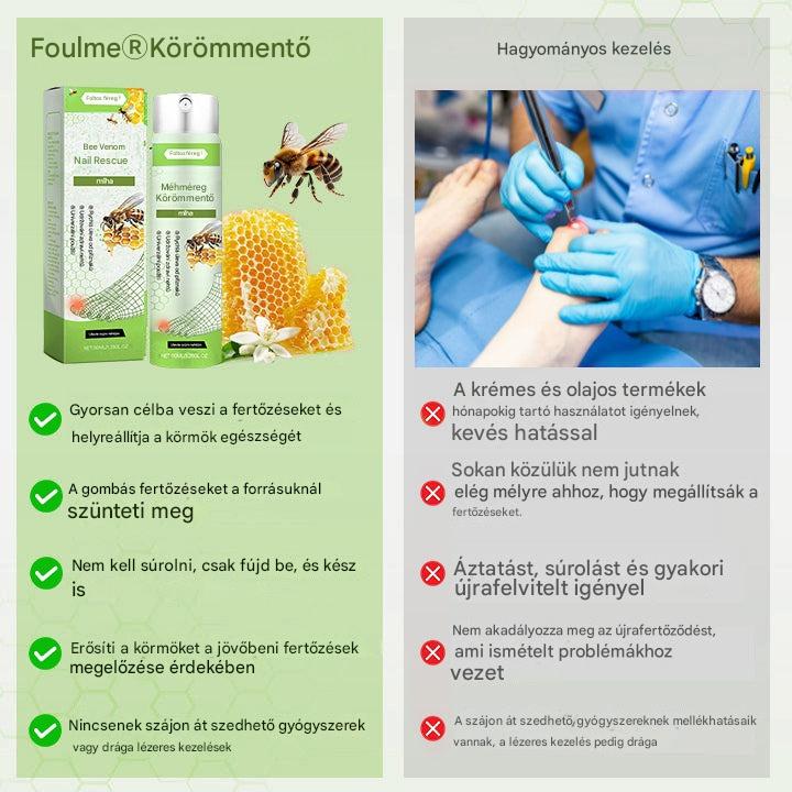 Korlátozott ideig 50%-os kedvezmény | Foulme® NailRescue Méhméreg Spray🎁
