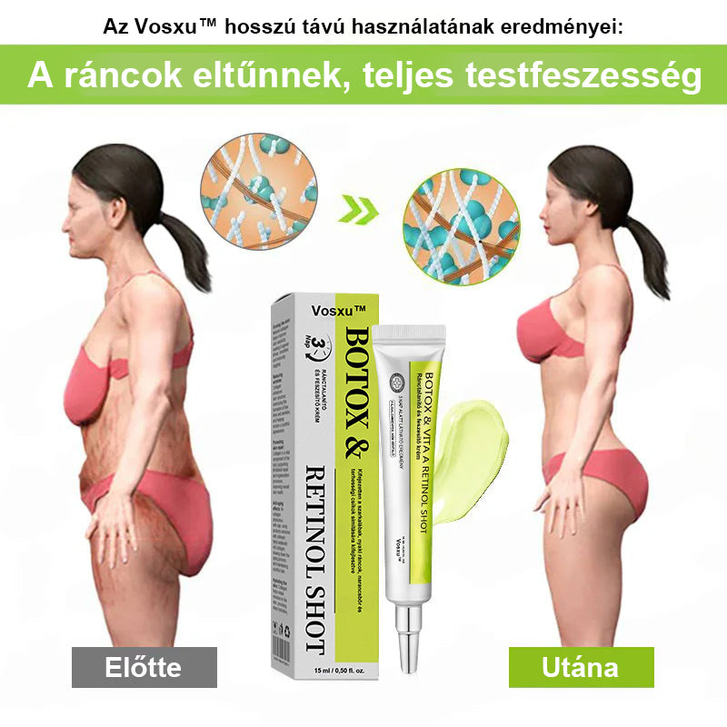 ✨ Vosxu™ Botox & Vita-A Retinol Shot ráncfelvarró szérum ✨ – 💉 Mikro-tűk | 💪 Botox-szerű peptidek | 🌿 Retinol | ⚡ Látható eredmények már 3 nap alatt🎁