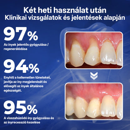 Rolimey® BeeTakt Méhméreg Fogápoló Cseppek Szájvíz✅