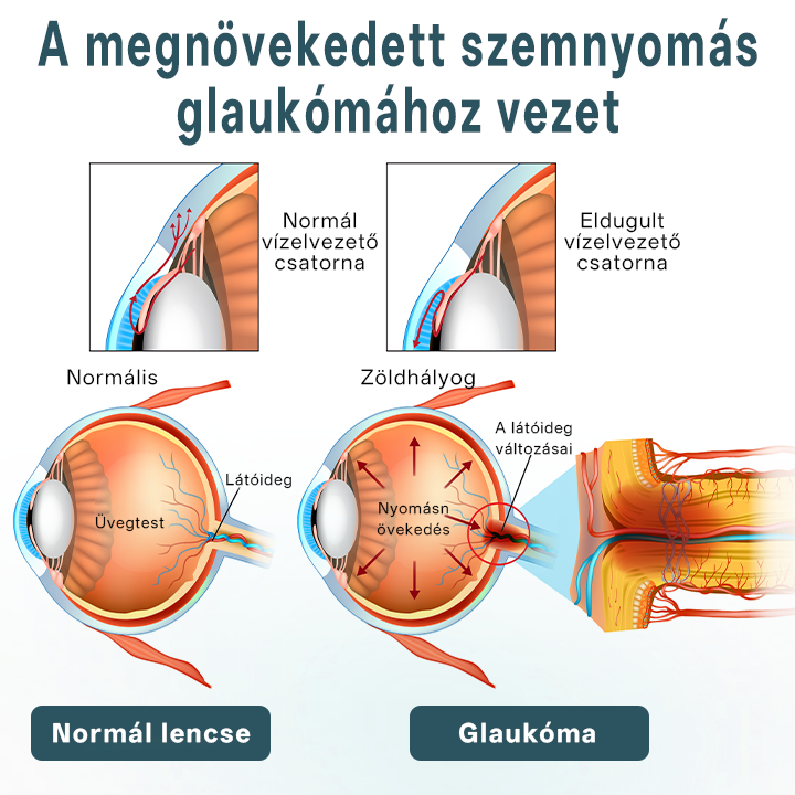 Timilk® OptiFusion Nano szemcsepp szérum🔥