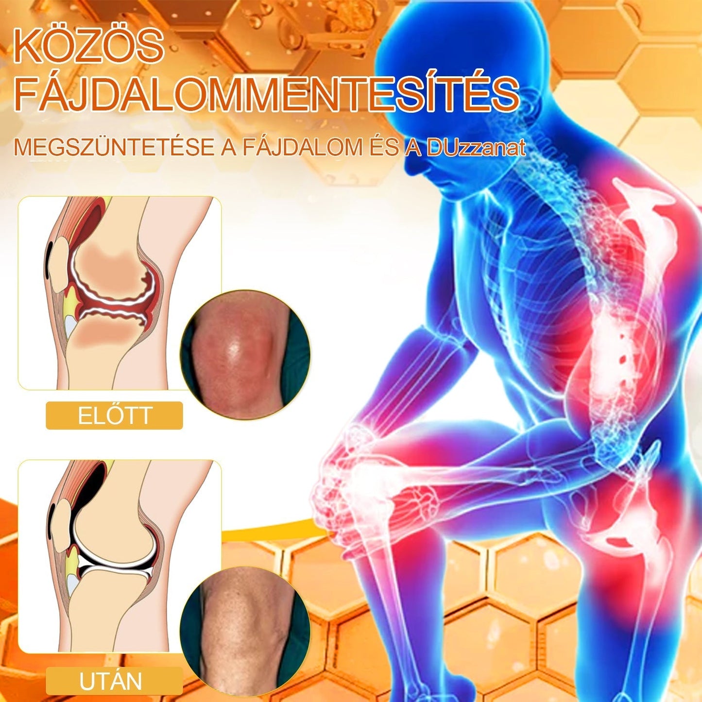 ✨VLSVLS™ Méhméreg Azonnali Ultra Erős Fájdalomcsillapító Krém👍 - (Enyhíti a fájdalmat ízületi gyulladás, izomfájdalom, hátfájás, térdek, hát, vállak, csípők, csuklók, kezek esetén)
