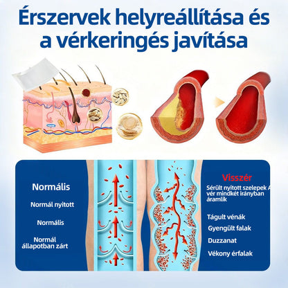 🇭🇺Yutuof® 👩‍⚕️VeinTarget mikrotűs tapasz⚡☑️Azonnali enyhülés hosszú távú eredmények⭐️