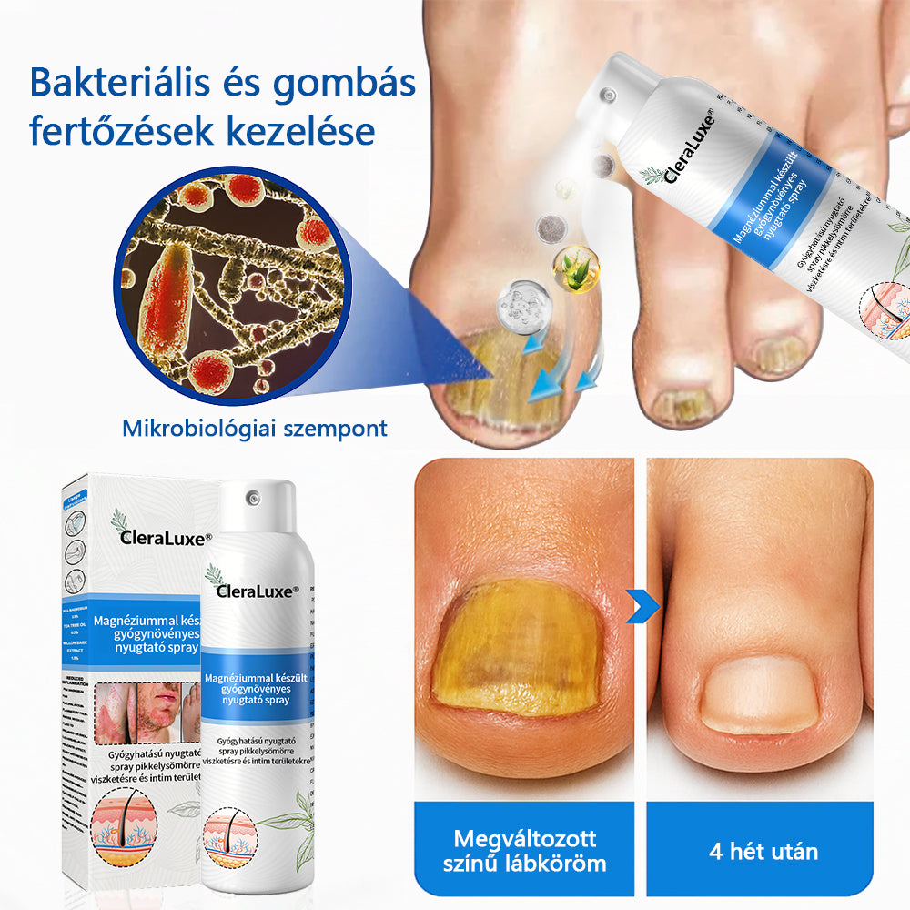 CleraLuxe®  Magnézium Gyógynövényes Pszoriázis Spray💦