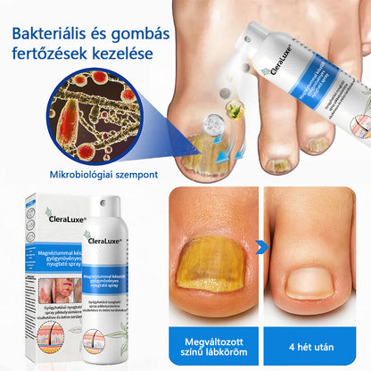 CleraLuxe®  Magnézium Gyógynövényes Pszoriázis Spray💦