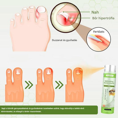 Korlátozott ideig 50%-os kedvezmény | Foulme® NailRescue Méhméreg Spray🎁