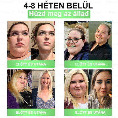 💎𝐆𝐞𝑒𝐿𝑒𝐦𝐨𝐧® Glumasetide 8 az 1-ben Karcsú és Egészséges Nano Mikrotűs Tapasz🩹
