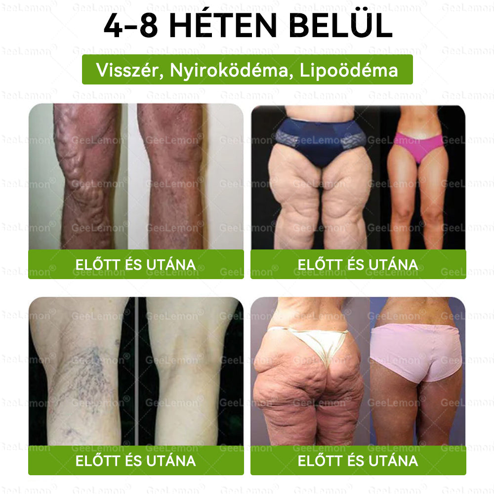 💎𝐆𝐞𝑒𝐿𝑒𝐦𝐨𝐧® Glumasetide 8 az 1-ben Karcsú és Egészséges Nano Mikrotűs Tapasz🩹