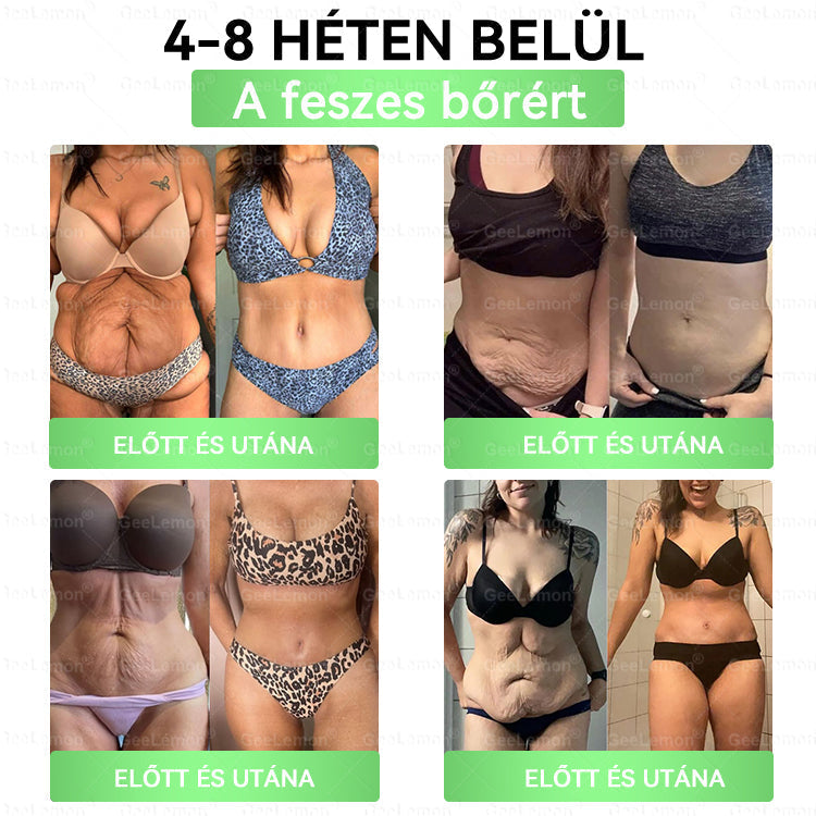💎𝐆𝐞𝑒𝐿𝑒𝐦𝐨𝐧® Glumasetide 8 az 1-ben Karcsú és Egészséges Nano Mikrotűs Tapasz🩹